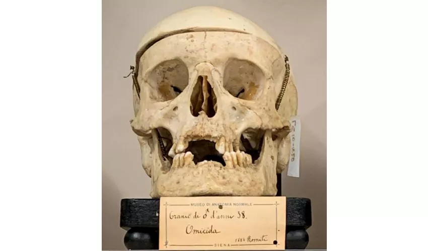 Museo Anatomico Leonetto Comparini