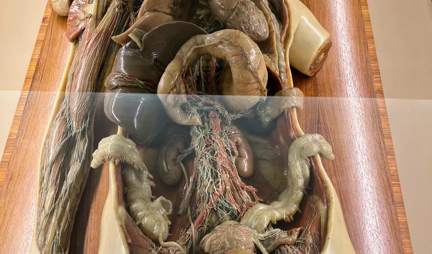 Collezione delle Cere Anatomiche "Luigi Cattaneo"